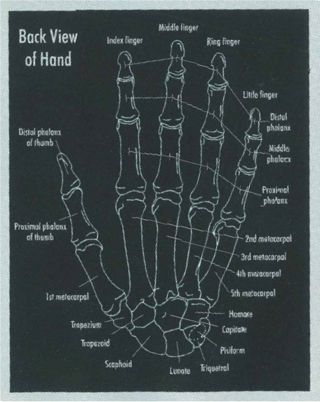 A black and white X-ray image of a human hand showing the phalanges, metacarpals, and carpal bones.